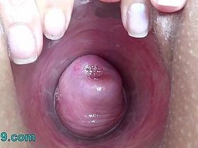 Electrosex for the cervix: A